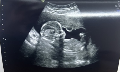 Gender guess