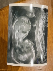 FET/IVF July 2023 - Thread 4