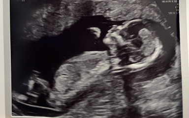 Gender guesses please!