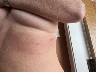 Can anyone identify this bite