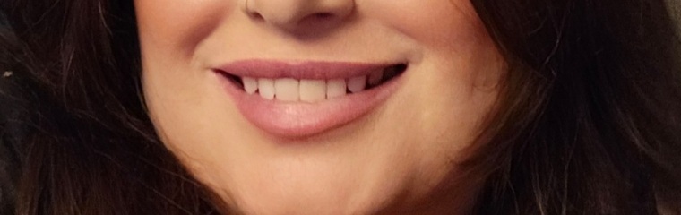 I hate my lips….fillers?