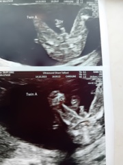 Potty shots twins