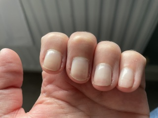 Nails filed too thin with drill, ouch