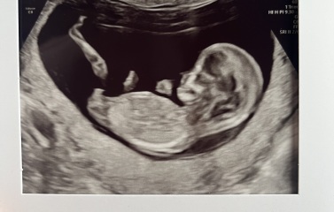 12 week scan gender guesses please ❤️