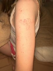 Anyone know what this rash could be