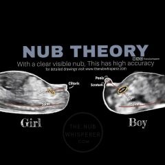 Different baby in each scan?!