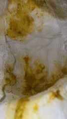 8 week is old poo [graphic photos]