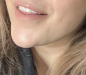 How to improve smile