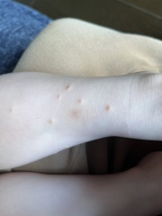 Any ideas on these little hard spots that have appeared?