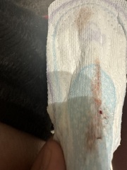 Need serious advice - TMI PHOTOS
