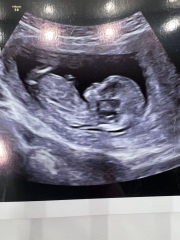 Gender help ! Ultrasound photo ☺️