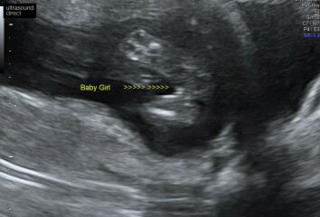 Is this deffo a girl?!