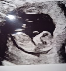 Boy or Girl