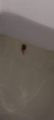 Is this a very early miscarriage? TW: Picture of tissue/miscarriage?
