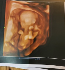 16+1 nub theory guesses!