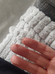 Any ideas what this could be on my hands?