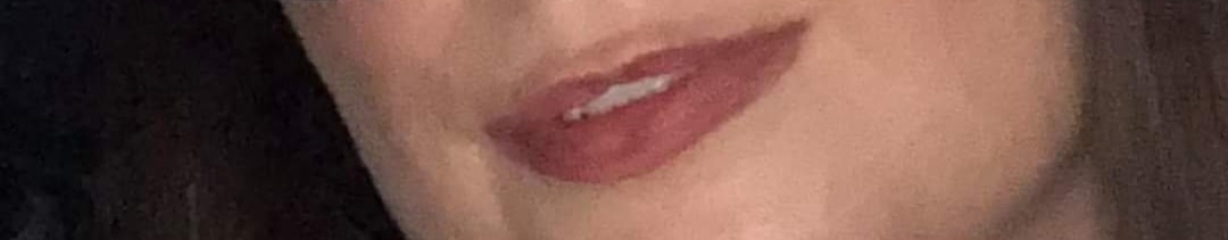 I hate my lips….fillers?