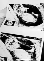 Guess the gender by these scan pics