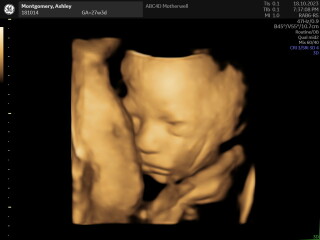 Due January 2024, Part 7!
