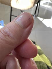 Nails filed too thin with drill, ouch