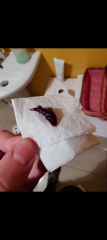 Decidual cast? Warning, gross picture.