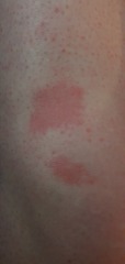 Strange red knees