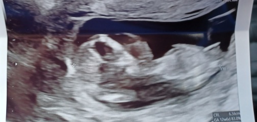 Boy or girl