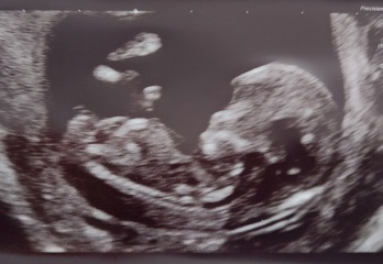 Nub/gender theory guesses - 12 weeks!
