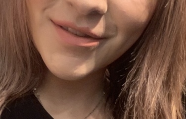 How to improve smile