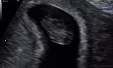 What is this on my baby scan?