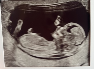 12 week scan gender guesses please ❤️