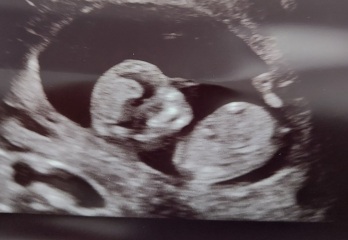 Nub/gender theory guesses - 12 weeks!