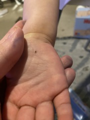 Anyone seen this before