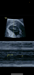 Early pregnancy scan pic…. Boy or girl?