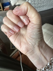Nails filed too thin with drill, ouch
