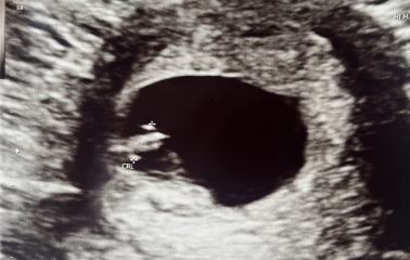 Positive outcome!