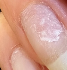 Gel manicure nails - damage?