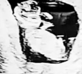 Guess the gender by these scan pics