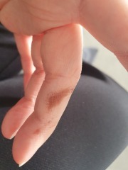 Any ideas what this could be on my hands?