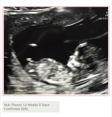 Has anyone had nub theory be wrong?