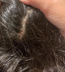 please advise is this dandruff , pic included
