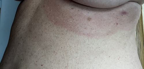 Can anyone identify this bite