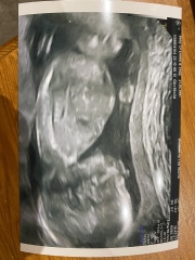 FET/IVF July 2023 - Thread 4