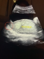 28 week scan ? Gender on show