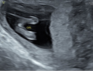 Gender help ! Ultrasound photo ☺️