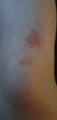 Strange red knees