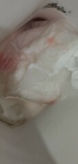 Is this implantation bleeding?