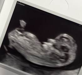 Gender guesses please!