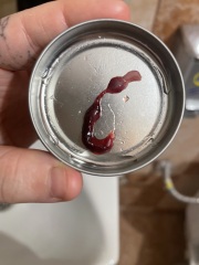 Is this a miscarriage? Please help. TRIGGER WARNING : PHOTOS