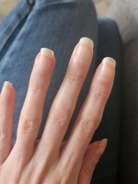 Anyone take collagen?